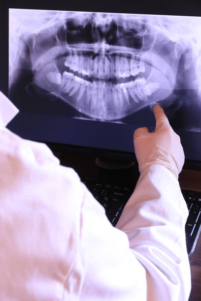 Best Emergency Treatment for Dental Infections or Abscesses in Anaheim, CA